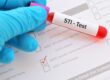 STI Testing: When to Get Tested, Common Infections, and Prevention Tips