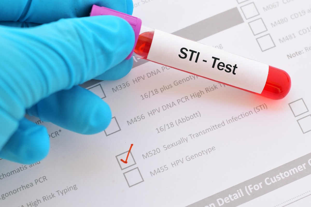 STI Testing: When to Get Tested, Common Infections, and Prevention Tips